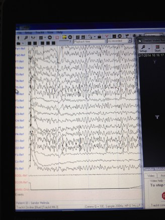 My Brain waves. 