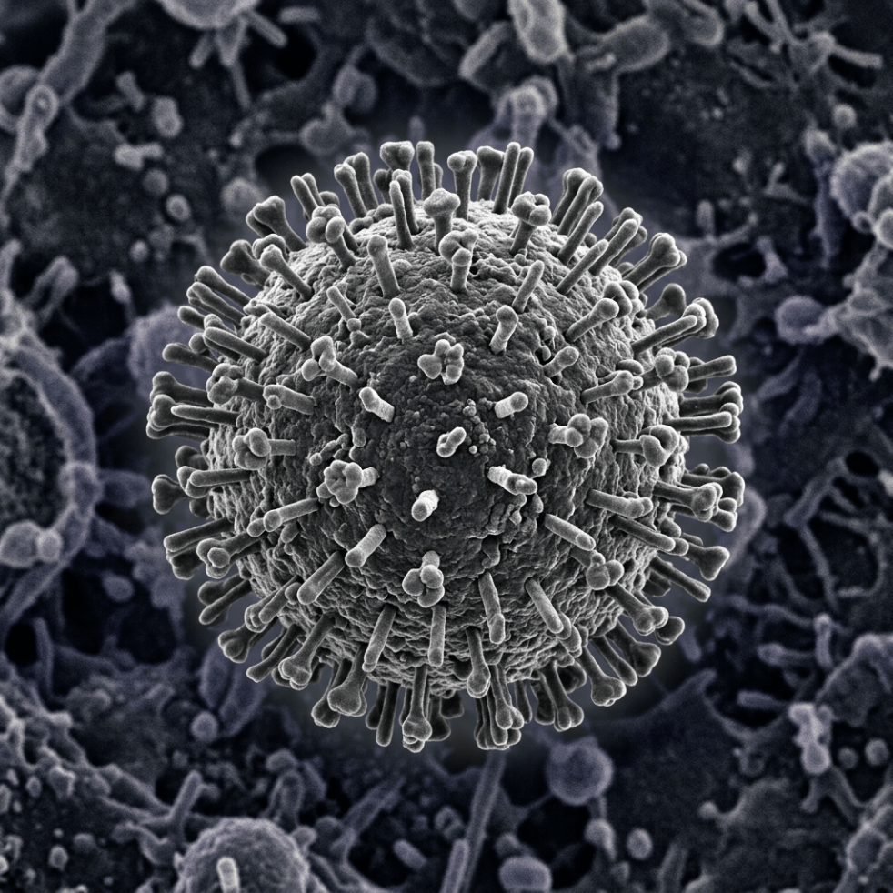 Spherical virus particle with numerous spike-like proteins extending outward
